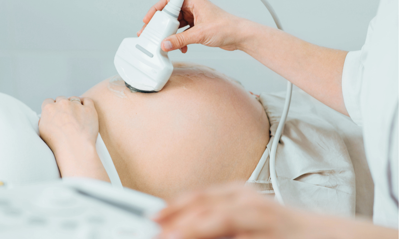 Ibu hamil scan bayi